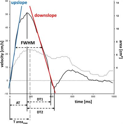 Assessment of pulmonary artery stiffness by multiparametric cardiac magnetic resonance-surrogate for right heart catheterization